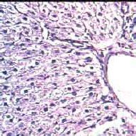 Photomicrograph Of Rat Liver Obtained From Different Treatment Groups