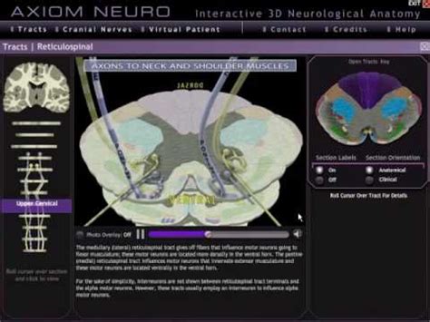 Axiom Neuro D Neuroanatomy Tracts And Pathways Module Youtube