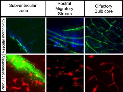 Differential Vascular Permeability Along The Forebrain Ventricular