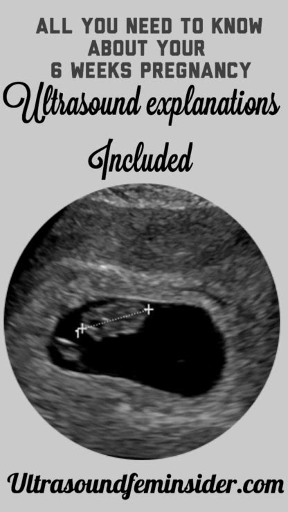 Normal first trimester 6 weeks ultrasound. - Ultrasoundfeminsider