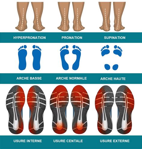 Comprendre Le Profil Dusure De La Semelle Des Chaussures OsteoMag