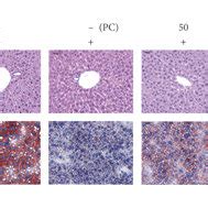 Effect Of DOFE On Alcohol Induced Liver Steatosis And Injury A