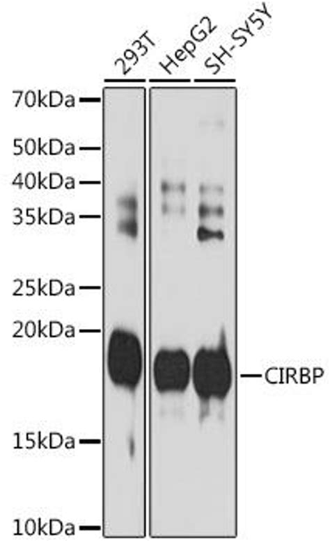 Anti Cirbp 抗体 Assay Genie