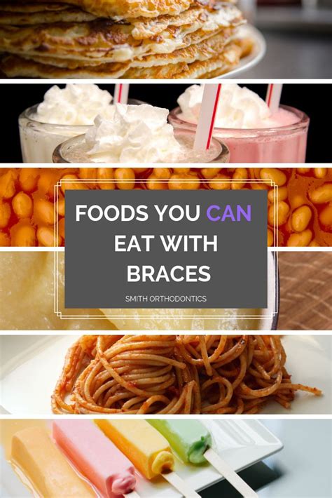 Food Can Eat With Braces