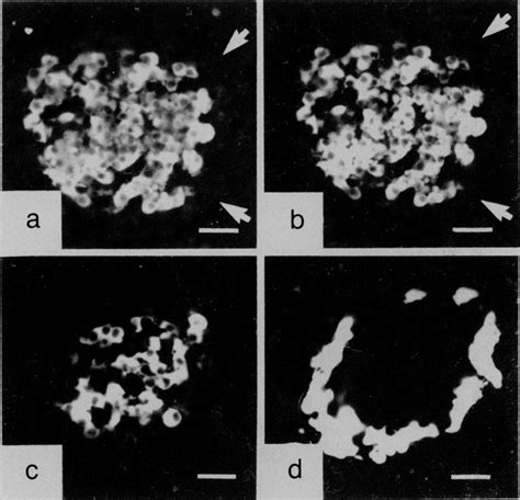 Autoantibodies To Glutamic Acid Decarboxylase In A Patient With Stiff Man Syndrome Epilepsy