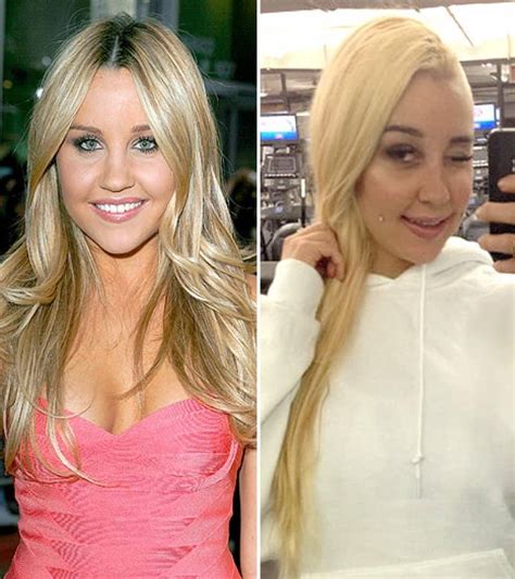 Worst Cases Of Celebrity Plastic Surgery Gone Wrong