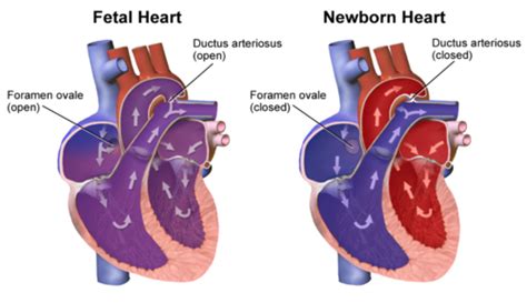 FETAL NEONATAL CIRCULATION Flashcards Quizlet