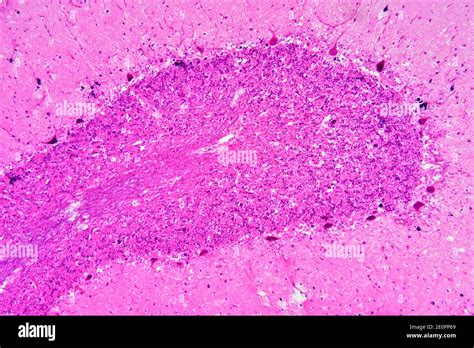 Purkinje Cells Histology