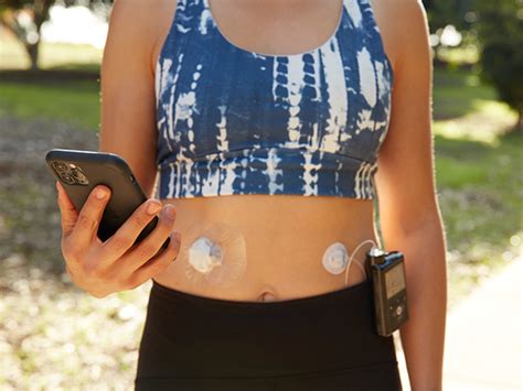 Insulin Pump Cgm Starter Kits