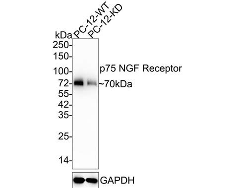 P75 NGF Receptor Recombinant Rabbit Monoclonal Antibody SA39 02 ET1