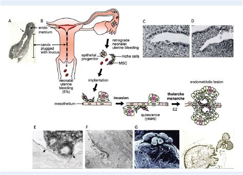 Figure 1 From Potential Role Of Endometrial Stemprogenitor Cells In The Pathogenesis Of Early