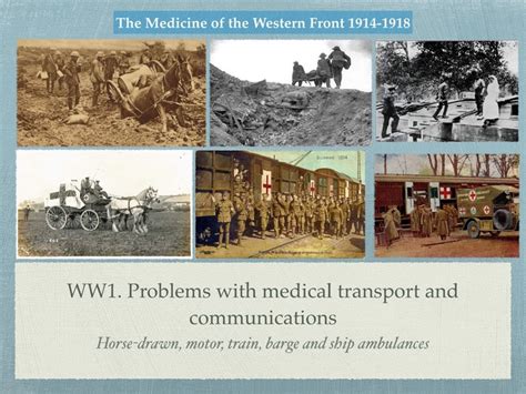 GCSE History Of Medicine WW1 Problems Of Transport And Communication