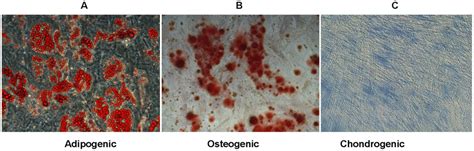 Trilineage Differentiation Of Hbm Msc After Long Term Culture On Download Scientific Diagram