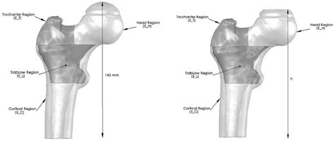 Four Regions Of The Fresh Frozen Bone Model The Trabecular Region Was