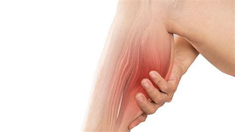 What is Myalgia: Causes, Symptoms & Treatments - Progressive Pain ...