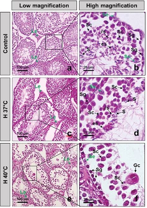 Figure 1 From Chronic Scrotal Heat Stress Causes Testicular