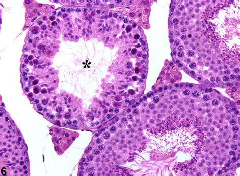 Testis Germinal Epithelium Degeneration Nonneoplastic Lesion Atlas