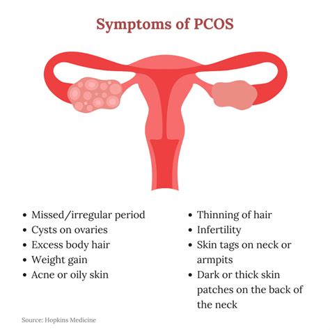 Pcos Vs Pcod Understanding The Differences And Symptoms