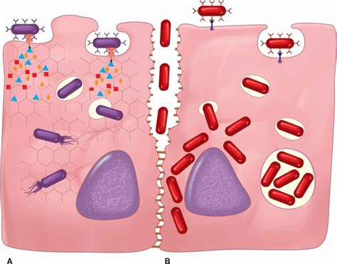 22 Pathogenesis Of Bacterial Infections Basicmedical Key