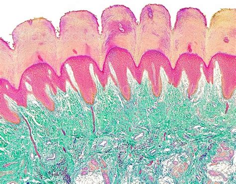 Photograph | Epidermal Ridges, LM | Science Source Images