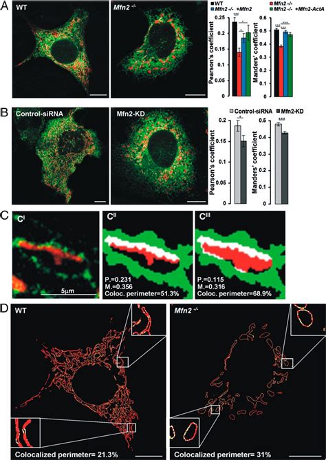 Mitofusin Ablation Increases Endoplasmic Reticulummitochondria