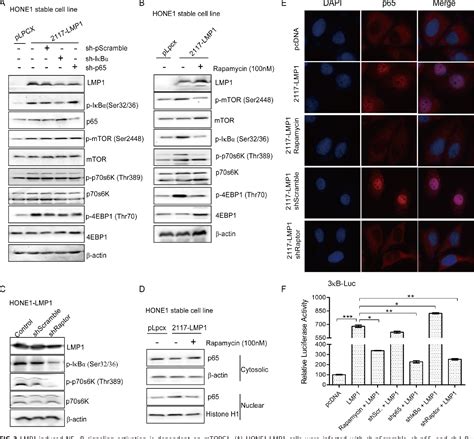 Figure 1 From Epstein Barr Virus Encoded Latent Membrane Protein 1