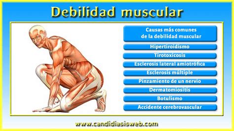 Otros S Ntomas Debilidad Muscular