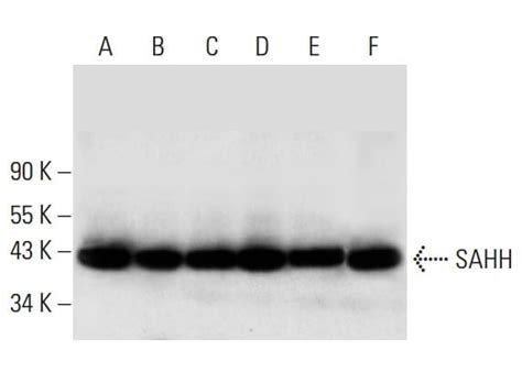 Anti Sahh Antibody A Scbt Santa Cruz Biotechnology