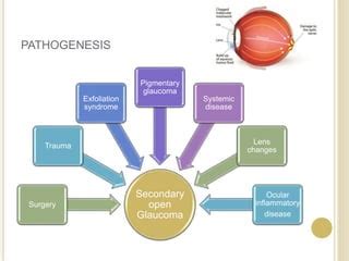 glaucoma types pathogenesis diagnosis  treatment pptx
