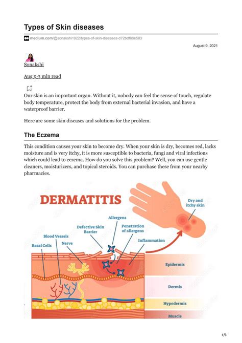 types Of Skin Diseases by Sonakshi A - Issuu