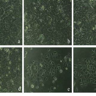 Morphological Changes In HeLa Tumor Cells Exposed To Ferulic Acid For