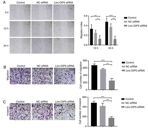 Linc‑oip5 Loss Regulates Migration And Invasion In Mda‑mb‑231 Breast