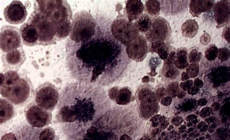 Difference Between Mold And Yeast (With Pictures) - VIVA DIFFERENCES