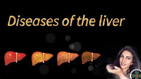 Diseases Of The Liver Youtube