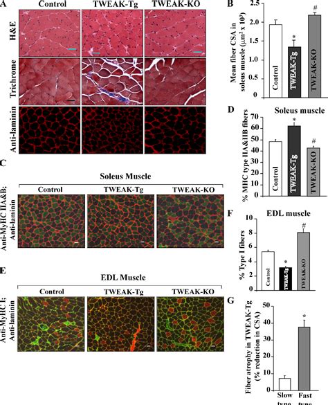 Figure From The Tweakfn System Is A Critical Regulator Of