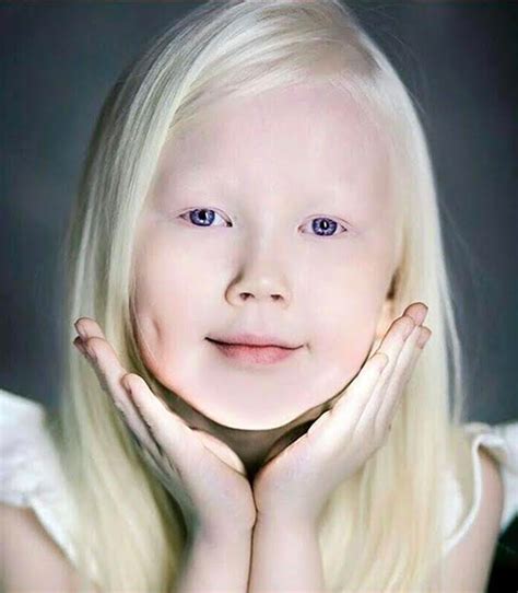 8 Yr Old Albino Girl’s Stunning Looks Have Modeling Offers Pouring In Albino Girl Albino