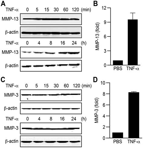 Tipe Inhibits Tnf Induced Hepatocellular Carcinoma Cell Metastasis