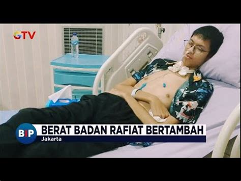 Kondisi Sultan Korban Kabel Menjuntai Membaik Berat Badan Nambah BIP