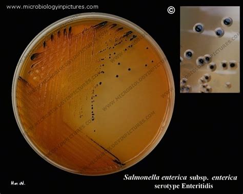 Salmonella Agar : Rambach Agar Chromogenic Media Focus On Salmonella ...