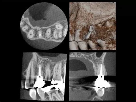 Morita Veraview D X E Dental