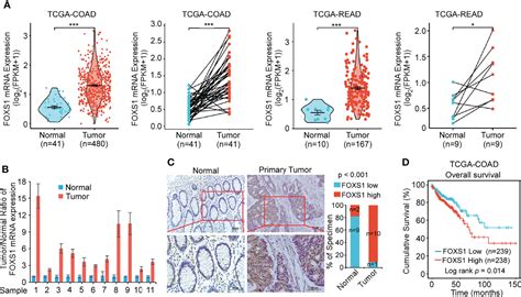 Frontiers FOXS1 Promotes Tumor Progression By Upregulating CXCL8 In