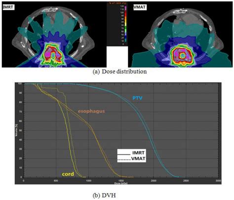 A Dose Distribution Comparison Between Mco Guided Mco Imrt And Vmat