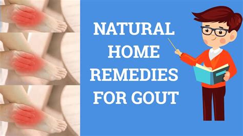 Treatment For Gout Natural Home Remedies For Gout Youtube