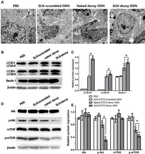 Effects Of SLN STAT3 Decoy ODN Complexes On Cancer Cell Autophagy In