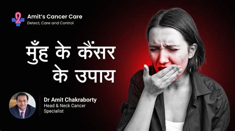 मुँह के कैंसर के उपाय Treatment For Mouth Cancer In Hindi Dr Amit