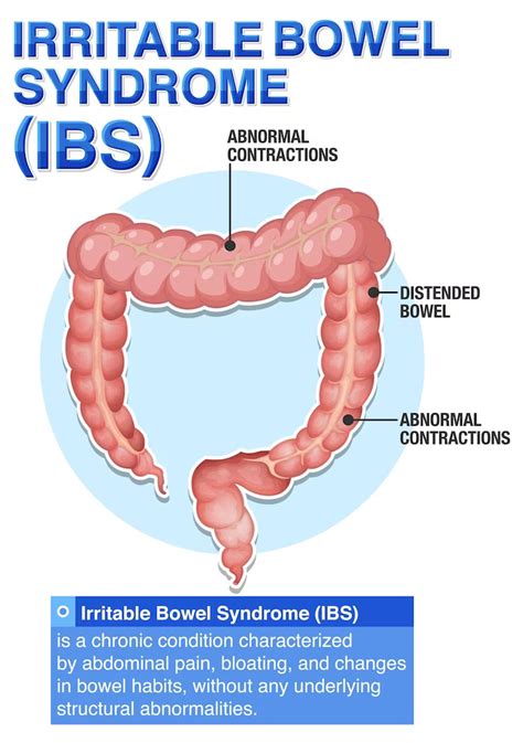 Irritable Bowel Syndrome Singapore Homeopathy