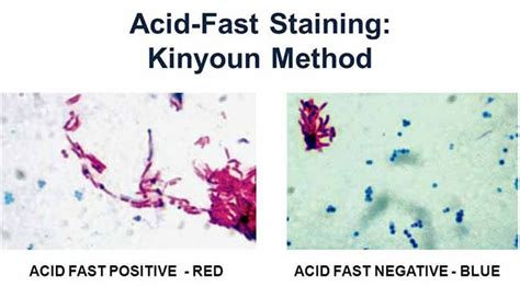 Acid Fast Stain Kinyoun Cold Method Principle Procedure And Result Interpretation