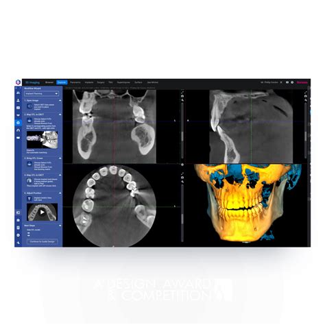 Romexis 6 Dental Imaging Software By Planmeca Design Interview Romexis 6