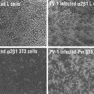 Development Of Cytopathic Effect Cpe After Virus Infection Cells