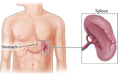 Spleen Pain - Area, Causes, Symptoms, Treatment, Pictures | Diseases ...